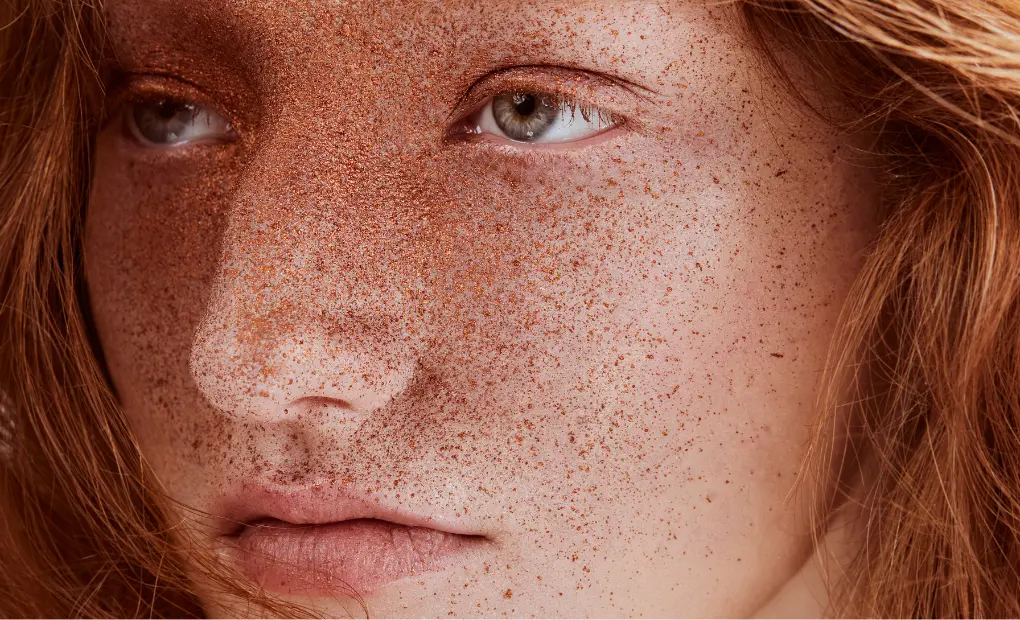 pecas ginger